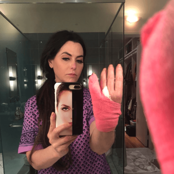 #RHOD Star D’Andra Simmons Rushed to ER After “Extremely Painful” Bloody Accident!