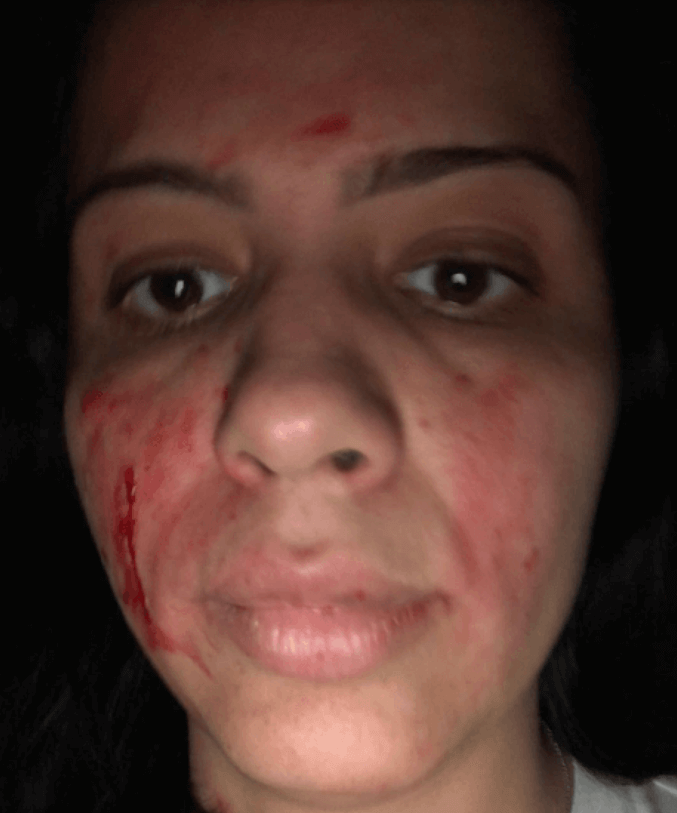 PHOTOS: ’90 Day Fiancé’ Larissa Arrested After Bloody Fight with Husband Colt Johnson!