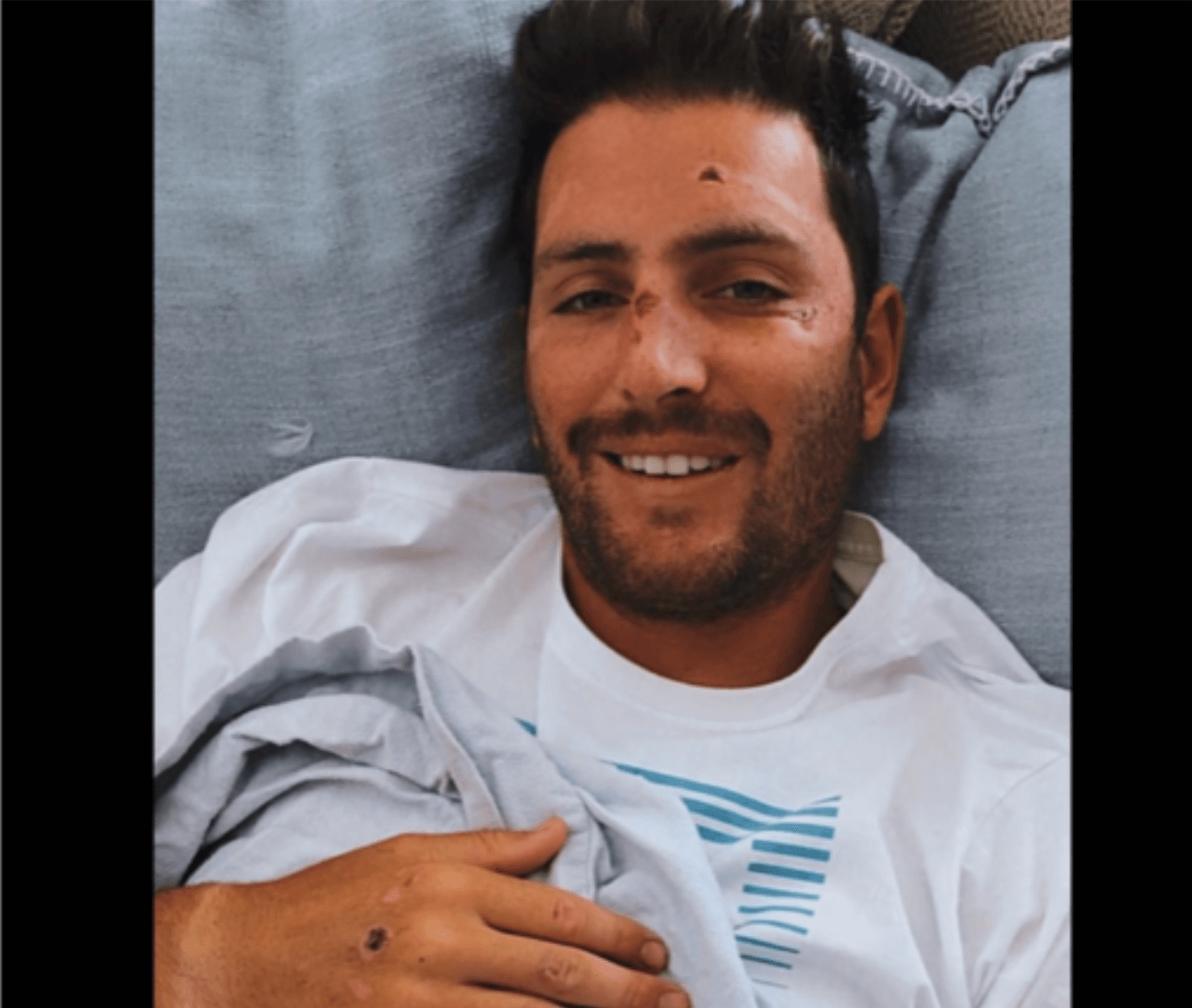 ‘Below Deck’ Star Tanner Sterback In ICU After Horrific Skateboard Accident!
