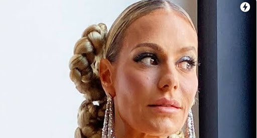 Dorit Kemsley Destroys Face — Looks 70 Yrs Old After Surgery!