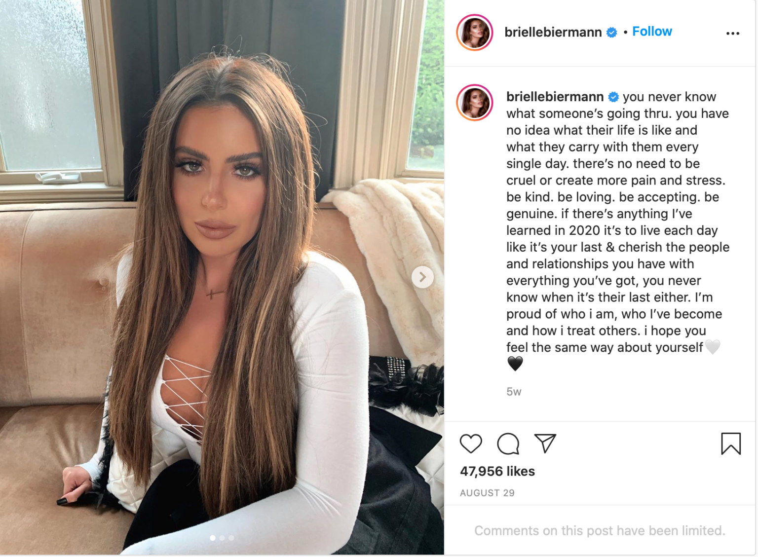 Brielle Biermann Has Face Dysmorphia Due to Fillers!