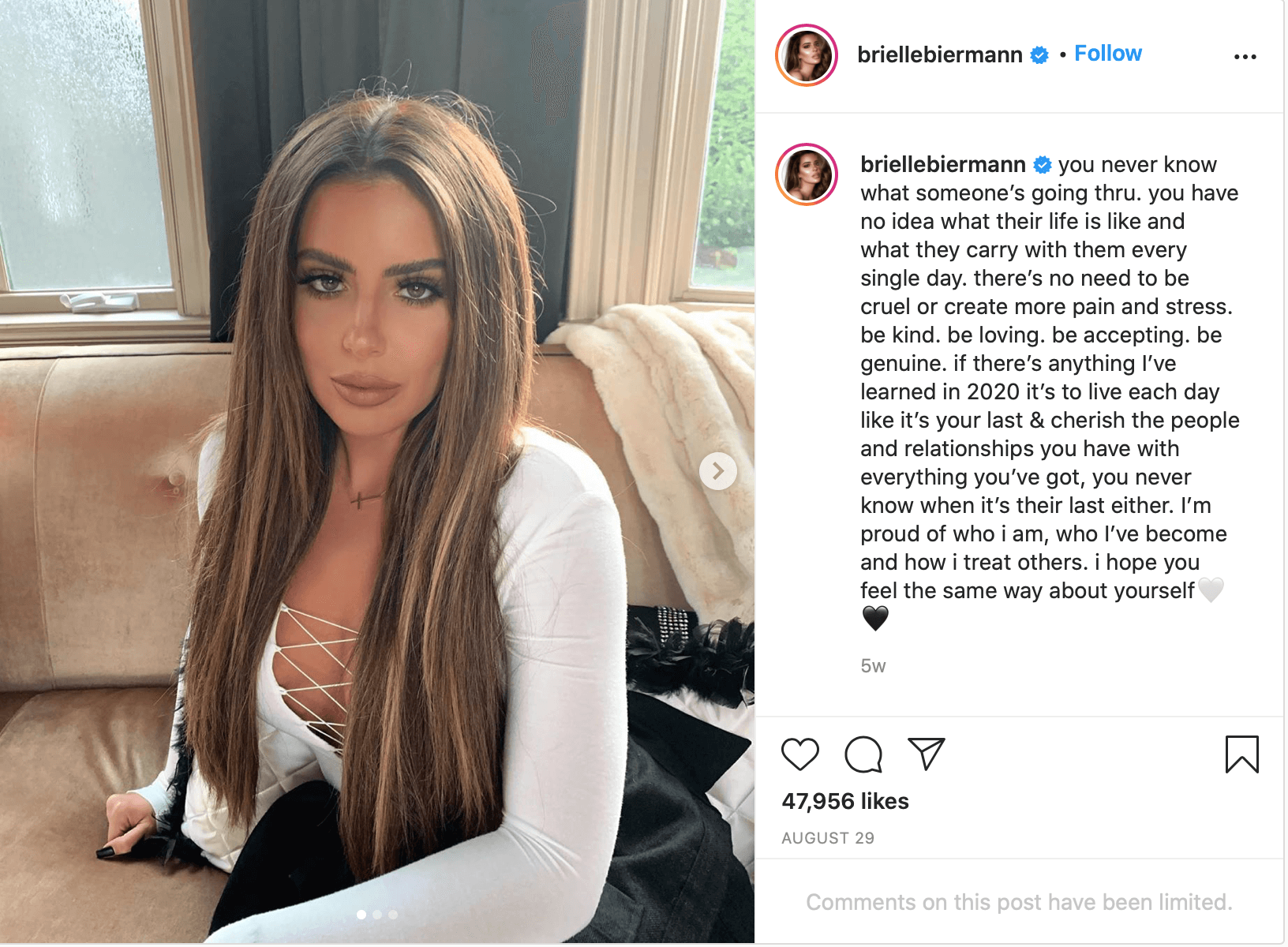 Brielle Biermann Has Face Dysmorphia Due To Fillers