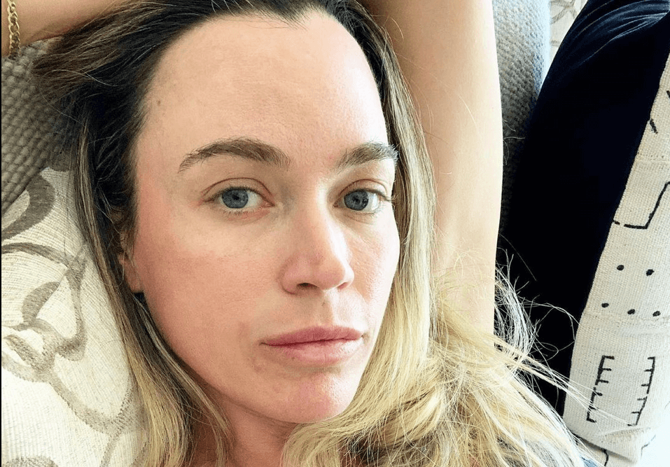 ‘RHOBH’ Alum Teddi Mellencamp Shows Off Bruised Face And Busted Lip After Fainting Due To Vertigo!