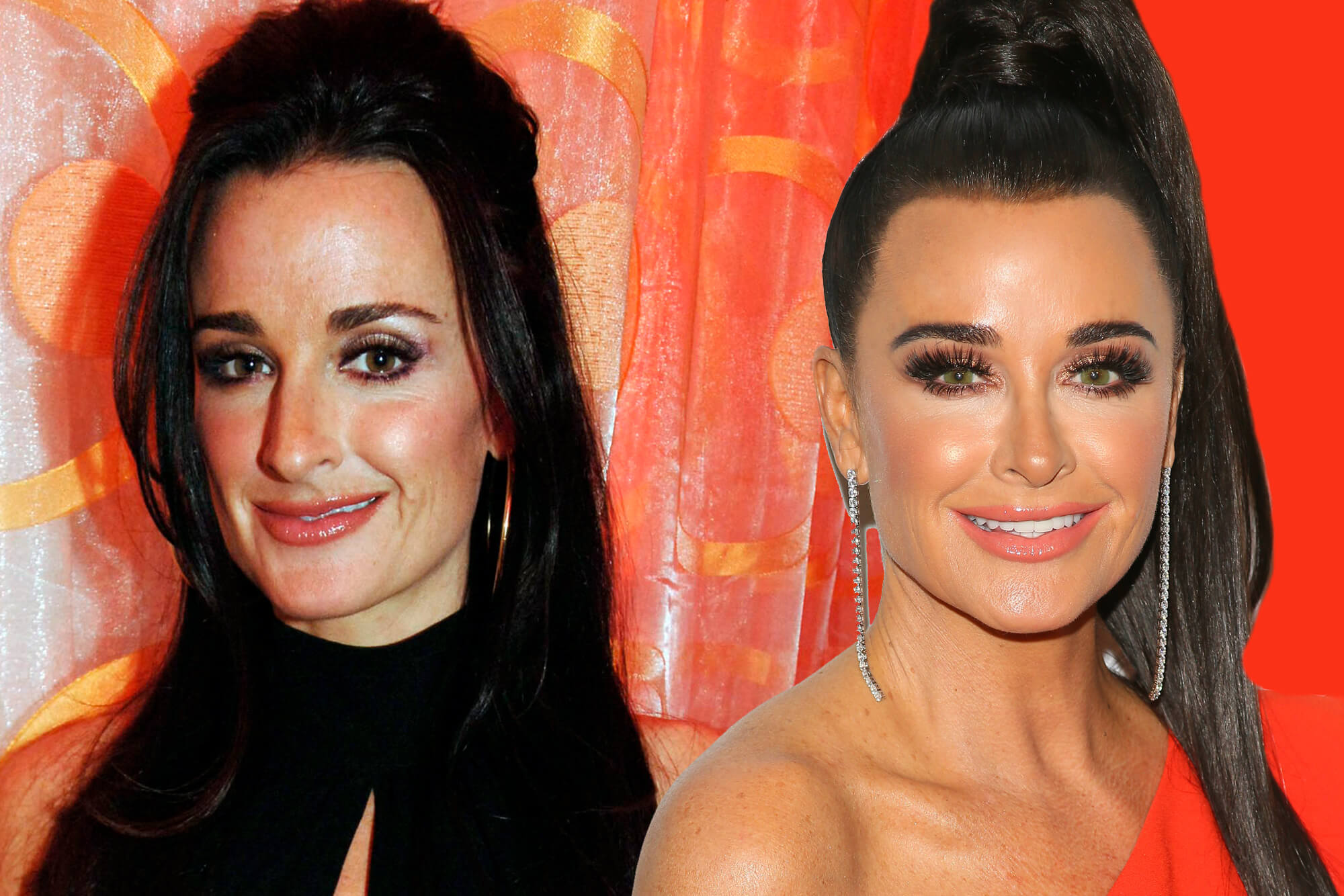 Kyle richards before and after veneers