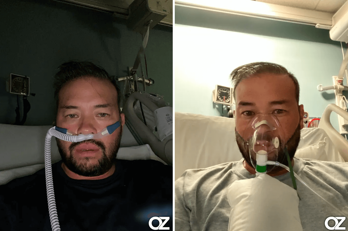 Jon Gosselin hospitalized after being bitten by deadly spider