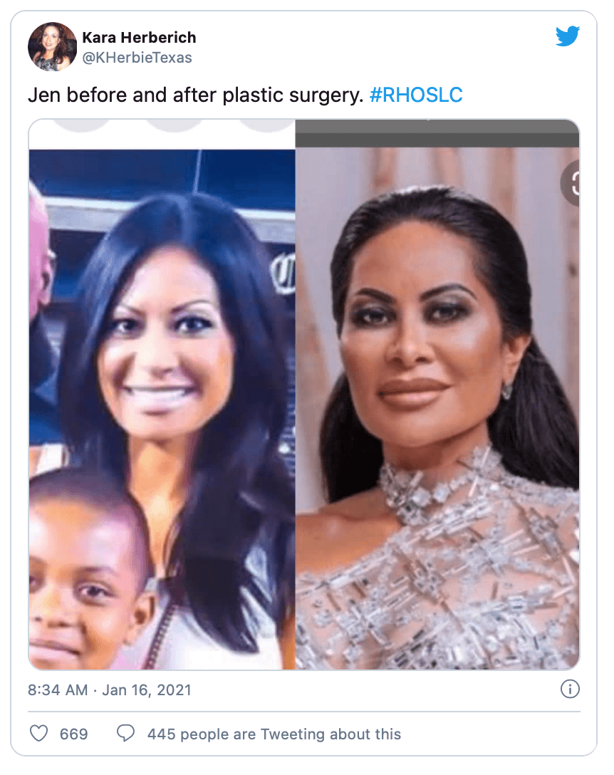 Image result for jen shah before plastic surgery