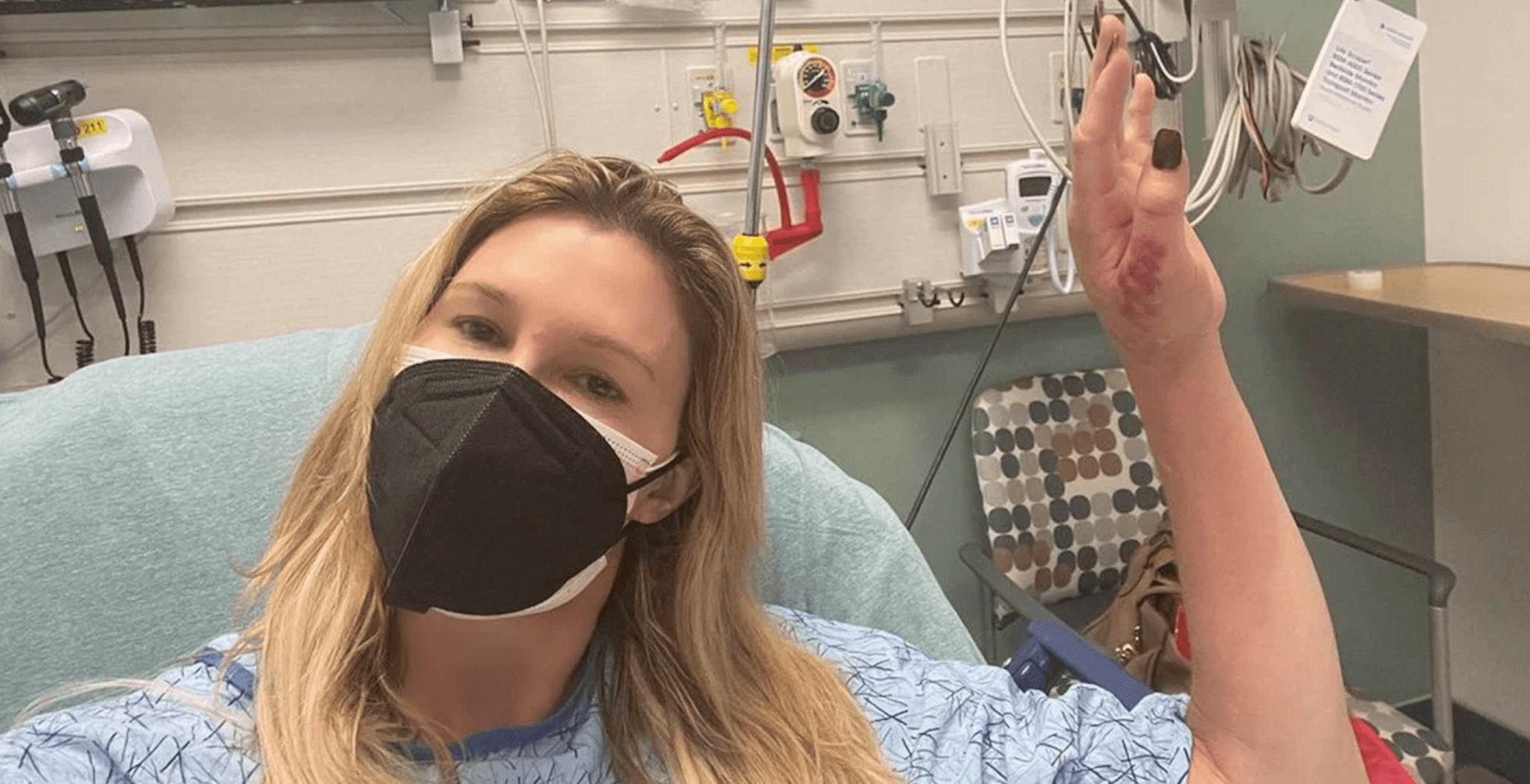 Brandi Glanville Hospitalized With ‘Hand And Arm Blown Like A Ballon’ Due To Mystery Infection: ‘I Could Lose A Limb’!