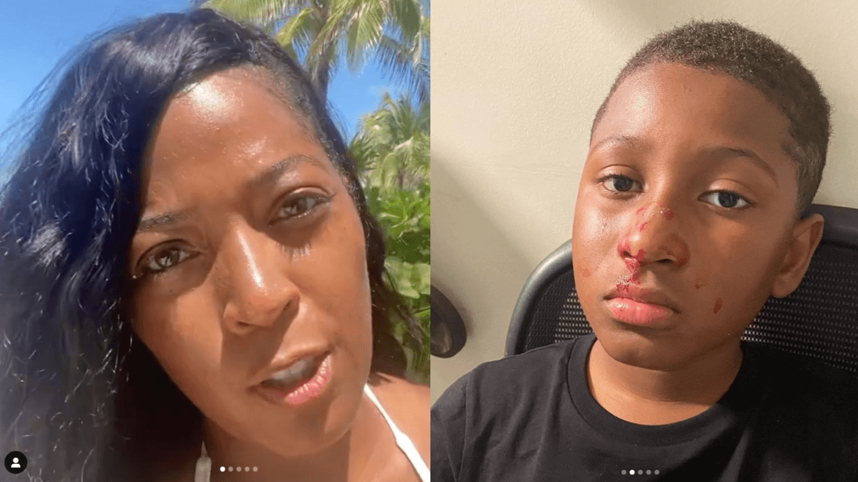 Toya Bush-Harris RIPS Restaurant & Hotel After Glass Menu Falls On Her Son, Leaving His Face Bloody And Scarred!