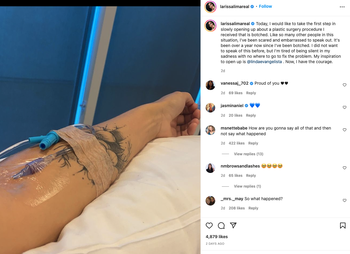 90 Day Fiancé' Star Reveals Doctors Removed Her Belly Button