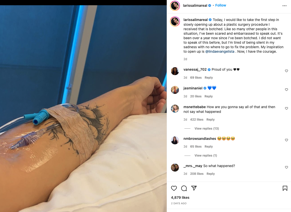 90 Day Fiancé' Alum Larissa Lima Opens Up About 'Botched' Plastic Surgery  and Lost Belly Button!