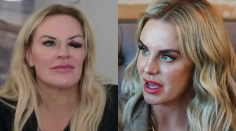 ‘RHOSLC’ Star Whitney Rose Spills Tea On Heather Gay’s Black Eye!