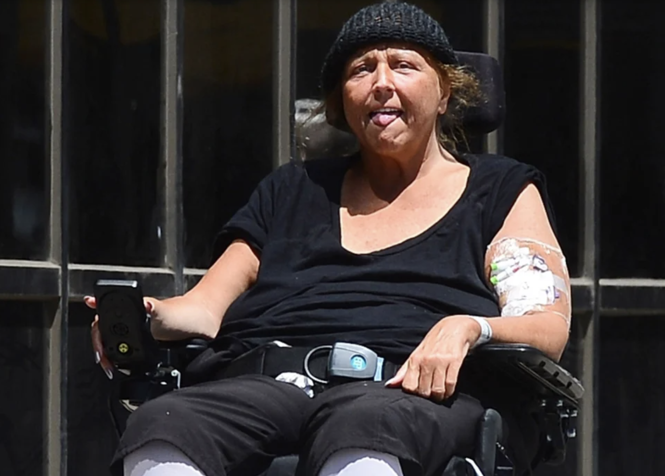 Descubrir 101 Imagen Why Is Abby Lee In A Wheelchair Abzlocal Mx