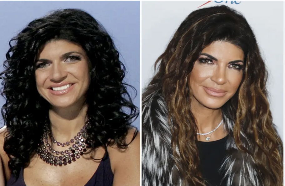 Teresa Giudice 