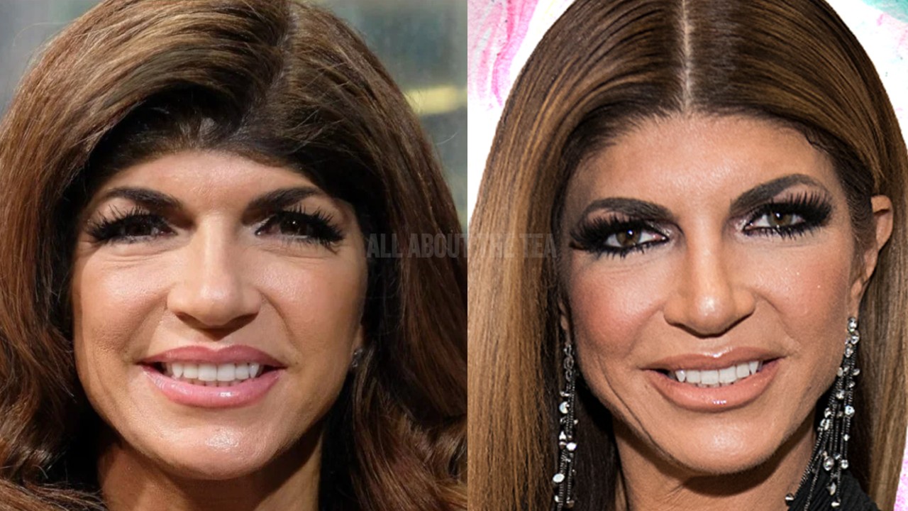 Did Teresa Giudice Get Forehead Lengthening? Details Inside Melissa Gorga's Claims