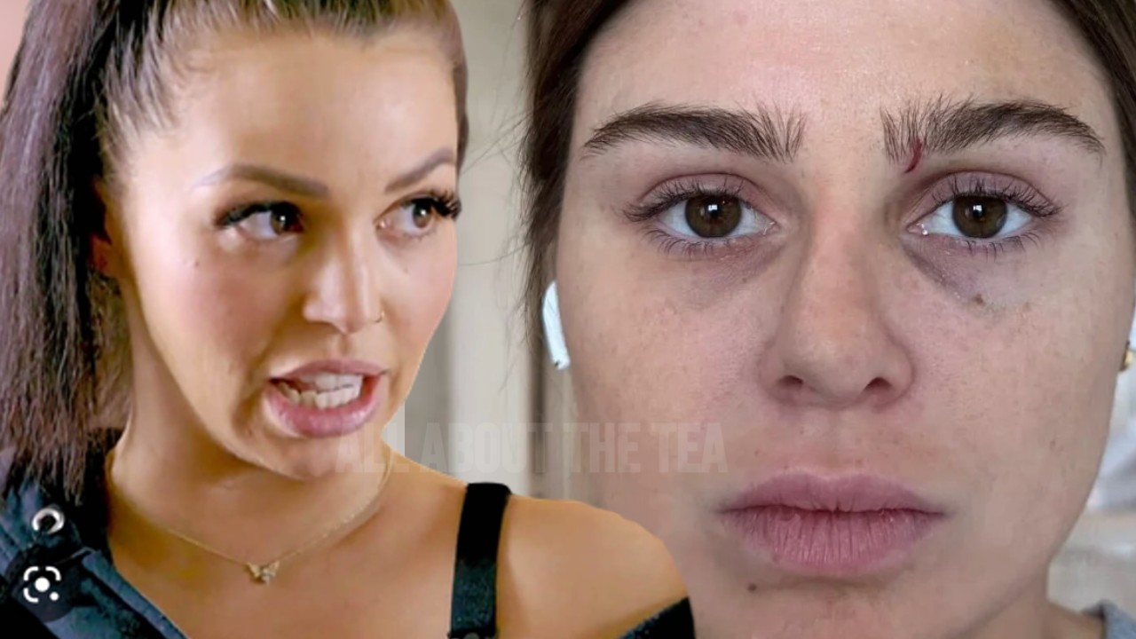 Scheana Shay Calls Raquel Leviss A ‘Liar’ Over Black Eye Claims and Fans Provide Receipts