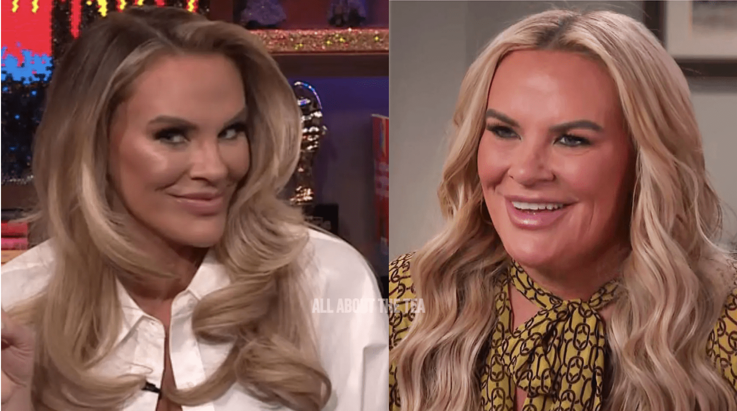 ‘RHOSLC’ Star Heather Gay Unveils NEW FACE…. New NOSE … and New CHIN!!