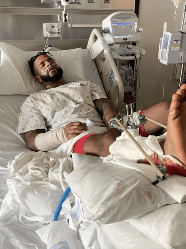 ‘The Challenge’ Star Nelson Thomas Undergoes Foot Amputation After Driving Drunk and Nearly Killing Himself