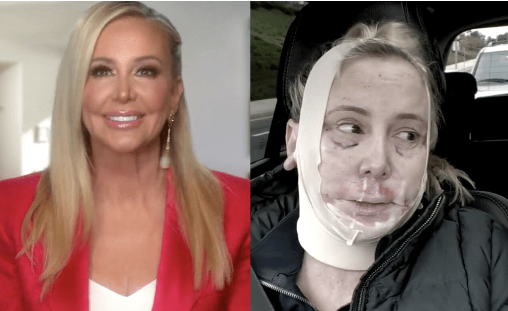 Shannon Beador