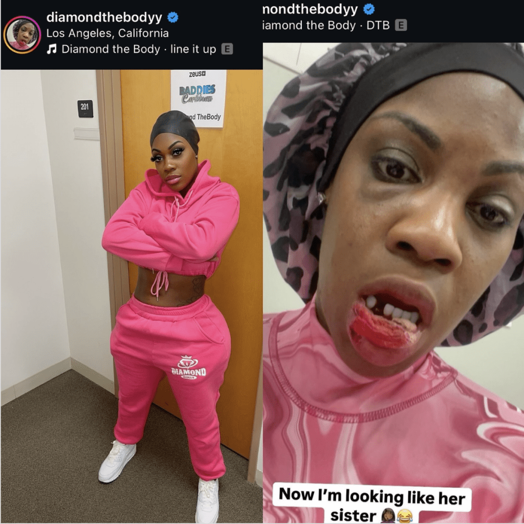 Tesehki Leaves Diamond The Body Toothless After Explosive Fight at