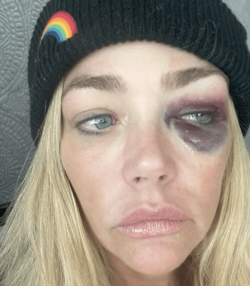 Denise Richards